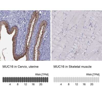 Immunohistochemistry-Paraffin: CA125/MUC16 Antibody [NBP2-62648] - Analysis in human cervix, uterine and skeletal muscle tissues using Anti-MUC16 antibody. Corresponding MUC16 RNA-seq data are presented for the same tissues.