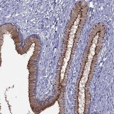Immunohistochemistry-Paraffin: CA125/MUC16 Antibody [NBP2-62648] - Staining of human cervix, uterine shows high expression.