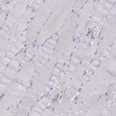 Immunohistochemistry-Paraffin: CA125/MUC16 Antibody [NBP2-62648] - Staining of human skeletal muscle shows low expression as expected.