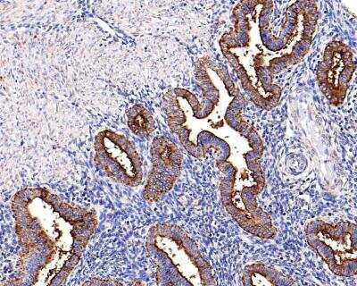 CA125/MUC16 Antibody (SN0715) [NBP2-67708] - CC staining of MUC16 in HepG2 cells (green). Formalin fixed cells were permeabilized with 0.1% Triton X-100 in TBS for 10 minutes at room temperature and blocked with 1% Blocker BSA for 15 minutes at room temperature. Cells were probed with the primary antibody for 1 hour at room temperature, washed with PBS. Alexa Fluor®488 Goat anti-Rabbit IgG was used as the secondary antibody at 1/1,000 dilution. The nuclear counter stain is DAPI (blue).