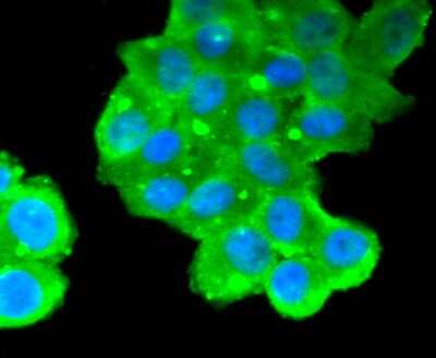 Immunocytochemistry/Immunofluorescence: CA125/MUC16 Antibody (SN69-06) [NBP2-67709] - Staining MUC16 in Hela cells (green). The nuclear counter stain is DAPI (blue). Cells were fixed in paraformaldehyde, permeabilised with 0.25% Triton X100/PBS.