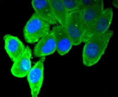 Immunocytochemistry/Immunofluorescence: CA125/MUC16 Antibody (SN69-06) [NBP2-67709] - ICC staining of CA125/MUC16 in HepG2 cells (green). Formalin fixed cells were permeabilized with 0.1% Triton X-100 in TBS for 10 minutes at room temperature and blocked with 1% Blocker BSA for 15 minutes at room temperature. Cells were probed with the primary antibody (1/50) for 1 hour at room temperature, washed with PBS. Alexa Fluor(R)488 Goat anti-Rabbit IgG was used as the secondary antibody at 1/1,000 dilution. The nuclear counter stain is DAPI (blue).