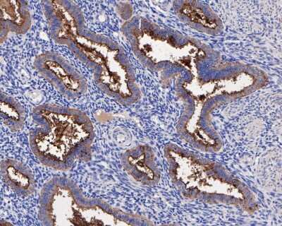 Immunohistochemistry-Paraffin: CA125/MUC16 Antibody (SN69-06) [NBP2-67709] - Immunohistochemical analysis of paraffin-embedded human uterus tissue using anti-CA125/MUC16 antibody. The section was pre-treated using heat mediated antigen retrieval with Tris-EDTA buffer (pH 8.0-8.4) for 20 minutes. The tissues were blocked in 5% BSA for 30 minutes at room temperature, washed with ddH2O and PBS, and then probed with the primary antibody (1/200) for 30 minutes at room temperature. The detection was performed using an HRP conjugated compact polymer system. DAB was used as the chromogen. Tissues were counterstained with hematoxylin and mounted with DPX.