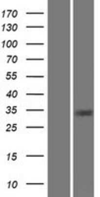 Western Blot: CA8 Overexpression Lysate (Adult Normal) [NBP2-07919] Left-Empty vector transfected control cell lysate (HEK293 cell lysate); Right -Over-expression Lysate for CA8.