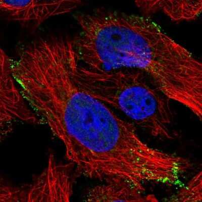 CAAP1 Antibody (NBP1-94020): Novus Biologicals