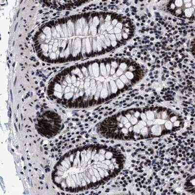 Immunohistochemistry-Paraffin: CAAP1 Antibody [NBP1-94018] - Staining of human colon shows strong nuclear positivity in glandular cells.