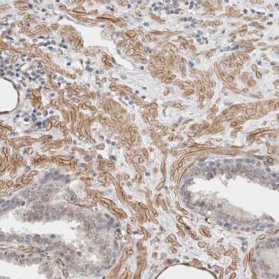 Immunohistochemistry-Paraffin: CAAP1 Antibody [NBP1-94020] - Staining of human prostate shows moderate cytoplasmic/membranous positivity in smooth muscle cells.