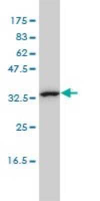 Western Blot: CAB39L Antibody (3B11-1A4) [H00081617-M01] - CAB39L monoclonal antibody (M01), clone 3B11-1A4 Analysis of CAB39L expression in K-562.