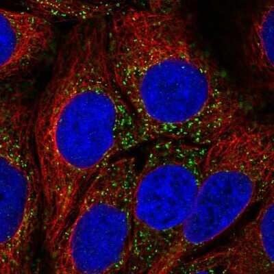 Immunocytochemistry/ Immunofluorescence CAB39L Antibody - BSA Free