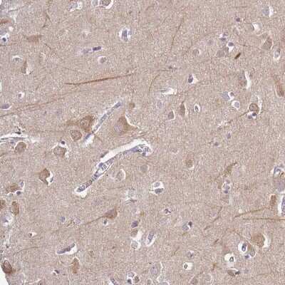Immunohistochemistry-Paraffin: CAB39L Antibody [NBP2-32039] - Staining of human cerebral cortex shows weak cytoplasmic positivity in neurons.