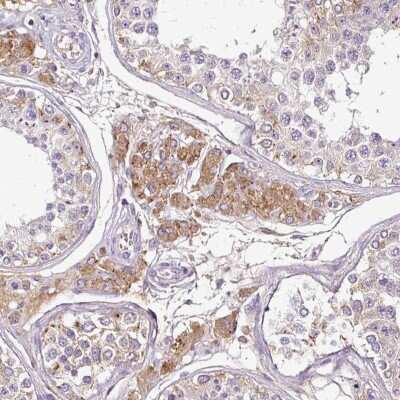 Immunohistochemistry-Paraffin: CAB39L Antibody [NBP2-32039] - Staining of human testis shows moderate cytoplasmic positivity in Leydig cells.