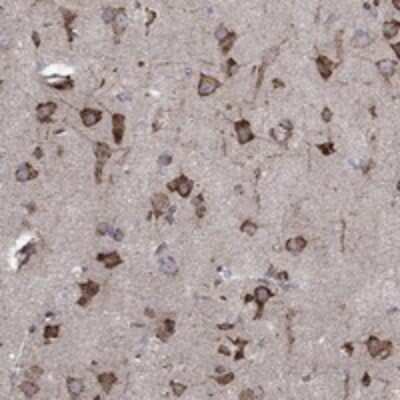 Immunohistochemistry-Paraffin: CAB39L Antibody [NBP3-17812] - Staining of human cerebral cortex shows strong cytoplasmic positivity in neuronal cells.