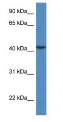 Western Blot: CAB39L Antibody [NBP1-74079] - COLO205 Cell Lysate 1ug/ml  Gel Concentration 12%