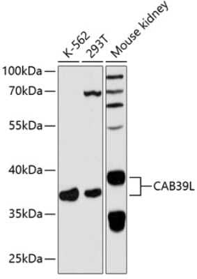 Western Blot CAB39L Antibody - Azide and BSA Free