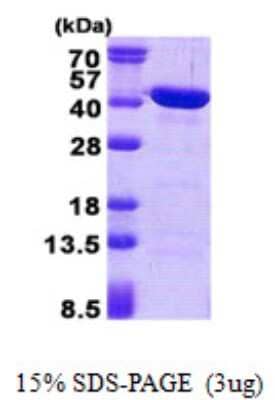 SDS-PAGE Recombinant Human CAB39L His Protein