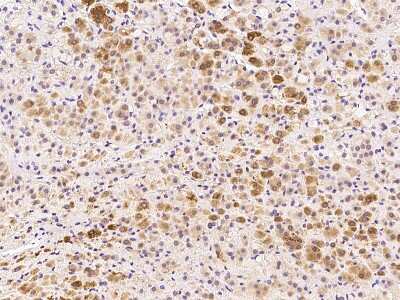 Immunohistochemistry-Paraffin: CABC1 Antibody [NBP2-99118] - Immunochemical staining of human CABC1 in human adrenal gland with rabbit polyclonal antibody at 1:300 dilution, formalin-fixed paraffin embedded sections.