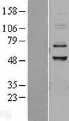 Western Blot: CABC1 Overexpression Lysate (Adult Normal) [NBL1-08622] Left-Empty vector transfected control cell lysate (HEK293 cell lysate); Right -Over-expression Lysate for CABC1.