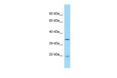 Western Blot: CABCOCO1 Antibody [NBP2-82967] - WB Suggested Anti-RGD1306739 Antibody. Titration: 1.0 ug/ml. Positive Control: Rat Spleen