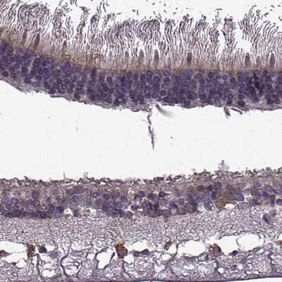 Immunohistochemistry-Paraffin CABP5 Antibody