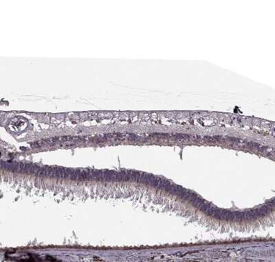 Immunohistochemistry-Paraffin CABP5 Antibody