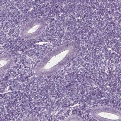 Immunohistochemistry-Paraffin CABP5 Antibody - BSA Free