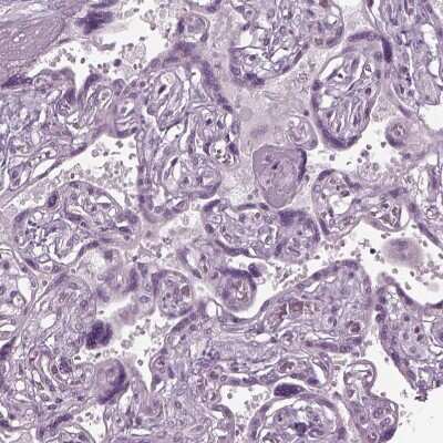 Immunohistochemistry-Paraffin CABP5 Antibody - BSA Free