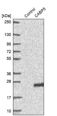 Western Blot CABP5 Antibody