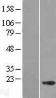 Western Blot: CABP5 Overexpression Lysate (Adult Normal) [NBP2-06699] Left-Empty vector transfected control cell lysate (HEK293 cell lysate); Right -Over-expression Lysate for CABP5.