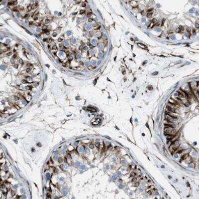 Immunohistochemistry: CABP7 Antibody [NBP2-30383] - Staining of human testis shows strong positivity in Sertoli cells.