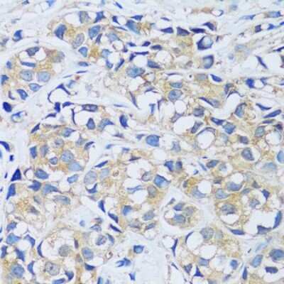 Immunohistochemistry-Paraffin CABP7 Antibody - Azide and BSA Free