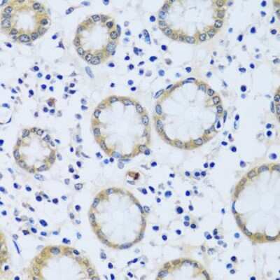 Immunohistochemistry-Paraffin CABP7 Antibody - Azide and BSA Free