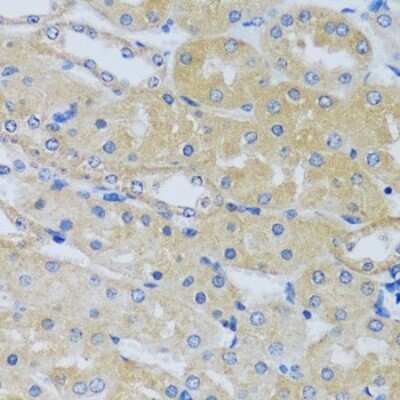 Immunohistochemistry-Paraffin CABP7 Antibody - Azide and BSA Free