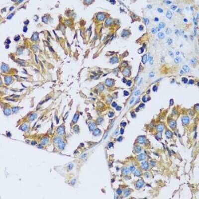 Immunohistochemistry-Paraffin: CABP7 Antibody [NBP2-92722] - Mouse testis using CABP7 antibody at dilution of 1:100 (40x lens).Perform microwave antigen retrieval with 10 mM PBS buffer pH 7.2 before commencing with IHC staining protocol.