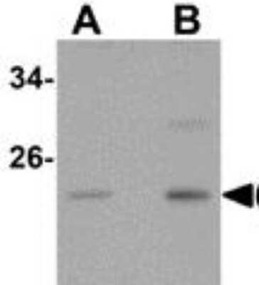 Western Blot: CABP7 Antibody [NBP1-77191] - Hela cell lysate with CaBP7 antibody at (A) 1 and (B) 2 ug/mL.