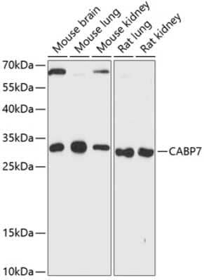 Western Blot: CABP7 Antibody [NBP2-92722] -  Analysis of extracts of various cell lines, using CABP7 antibody at 1:3000 dilution.Secondary antibody: HRP Goat Anti-Rabbit IgG (H+L) at 1:10000 dilution.Lysates/proteins: 25ug per lane. Blocking buffer: 3% nonfat dry milk in TBST.Detection: ECL Enhanced Kit. Exposure time: 90s.