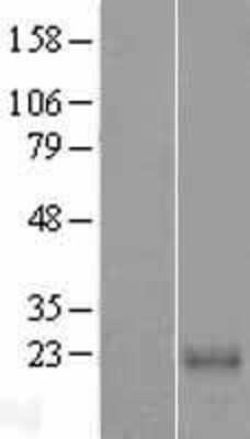 Western Blot: CABP7 Overexpression Lysate (Adult Normal) [NBL1-08625] Left-Empty vector transfected control cell lysate (HEK293 cell lysate); Right -Over-expression Lysate for CABP7.