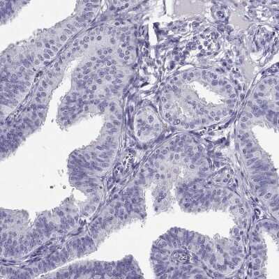 Immunohistochemistry-Paraffin CABS1 Antibody - BSA Free