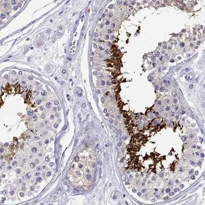 Immunohistochemistry-Paraffin CABS1 Antibody - BSA Free