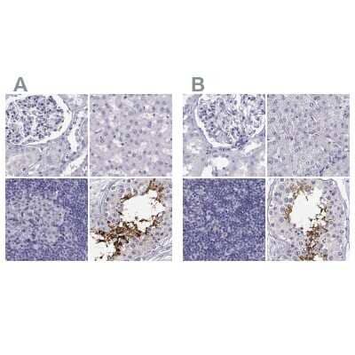 Immunohistochemistry-Paraffin CABS1 Antibody - BSA Free
