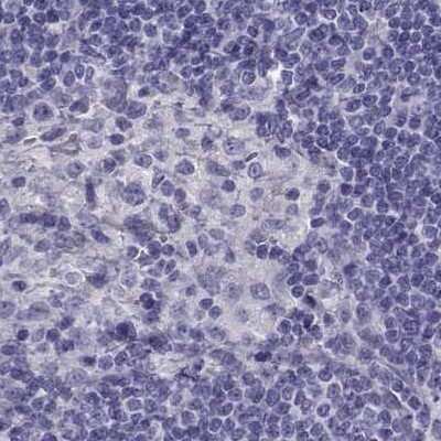 Immunohistochemistry-Paraffin CABS1 Antibody - BSA Free