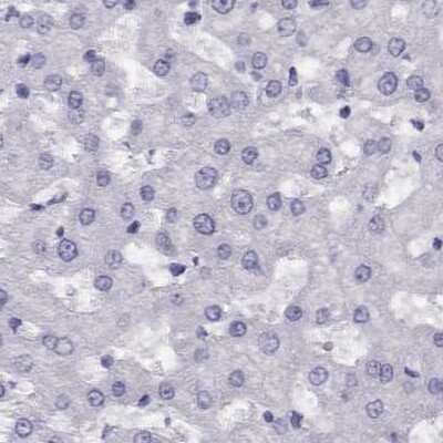 Immunohistochemistry-Paraffin CABS1 Antibody - BSA Free