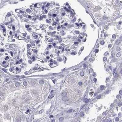Immunohistochemistry-Paraffin CABS1 Antibody - BSA Free