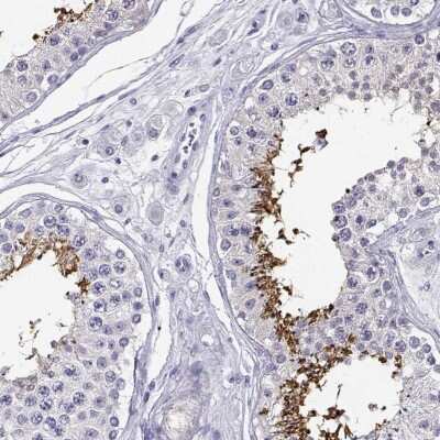 Immunohistochemistry-Paraffin CABS1 Antibody - BSA Free