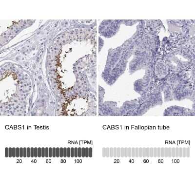 Immunohistochemistry-Paraffin CABS1 Antibody - BSA Free