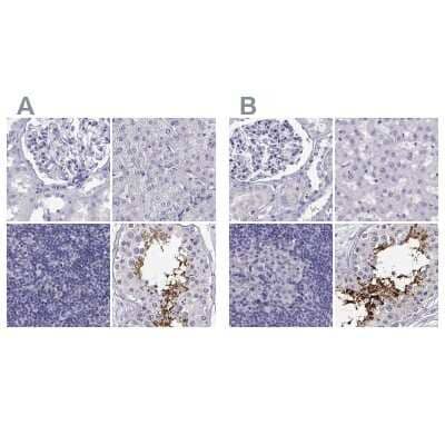 Immunohistochemistry-Paraffin CABS1 Antibody - BSA Free