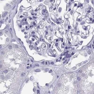 Immunohistochemistry-Paraffin CABS1 Antibody - BSA Free