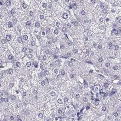Immunohistochemistry-Paraffin CABS1 Antibody - BSA Free