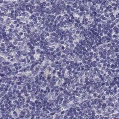 Immunohistochemistry-Paraffin CABS1 Antibody - BSA Free
