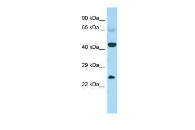 Western Blot: CABS1 Antibody [NBP3-10715] - Western blot analysis of CABS1 in Fetal Heart lysates. Antibody dilution at 1.0ug/ml