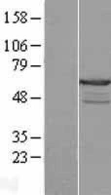 Western Blot: CABS1 Overexpression Lysate (Adult Normal) [NBL1-08476] Left-Empty vector transfected control cell lysate (HEK293 cell lysate); Right -Over-expression Lysate for CABS1.